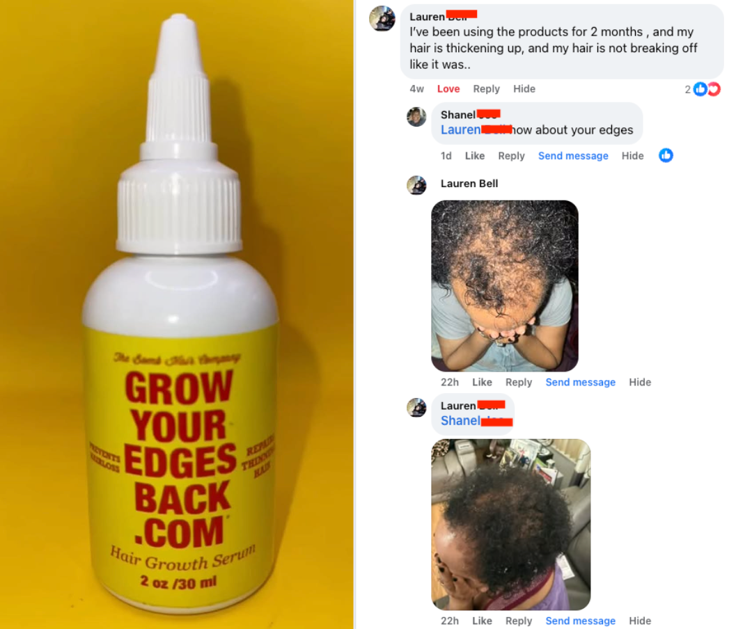 Grow Your Edges Back Full Hair & Edge Growth Bundle w/ FREE Edge Brush