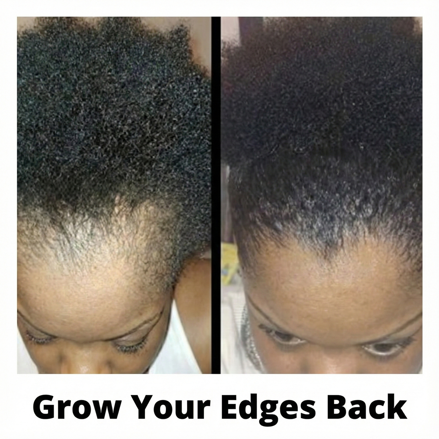 Grow Your Edges Back Dynamic Duo before and after transformation — edges growing back in 60 days