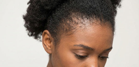 Close-up of dry brittle hair breaking along the hairline
