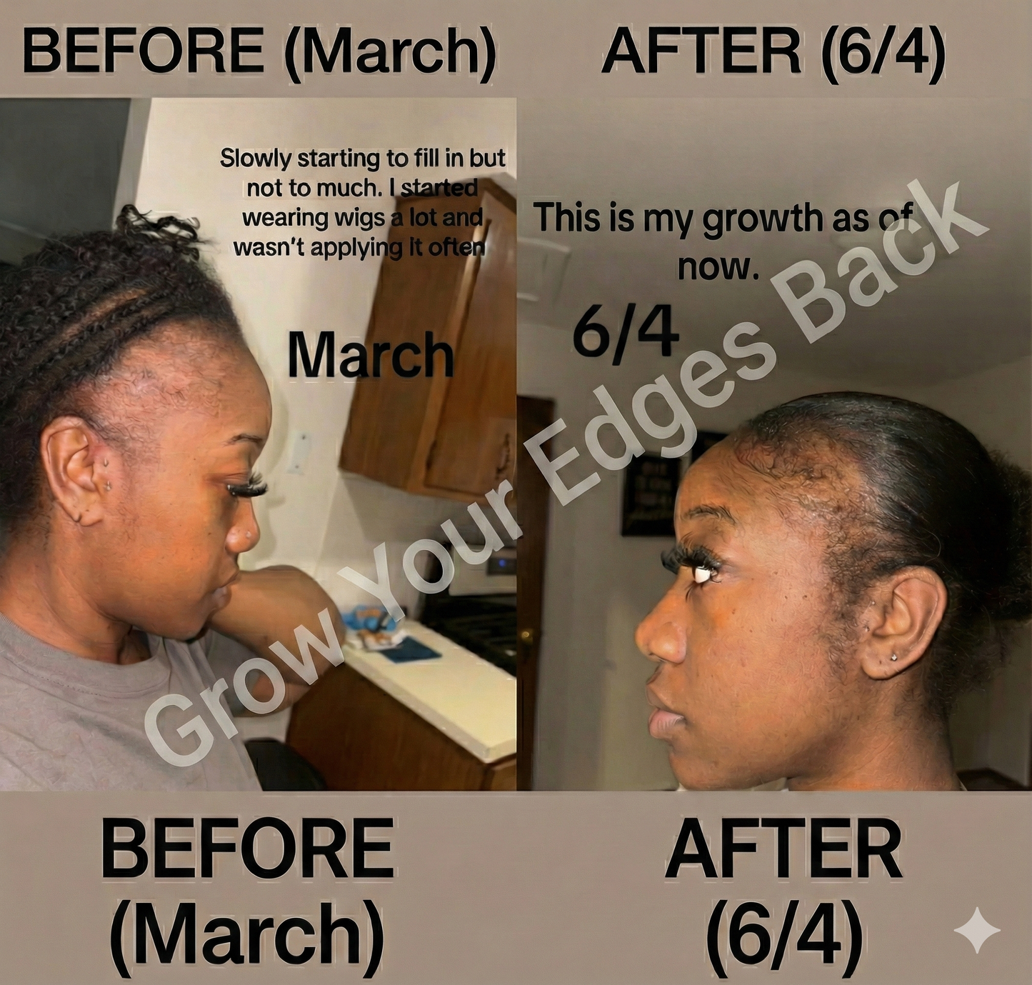 Edge & Hair Growth Oil w/ FREE Edge Brush