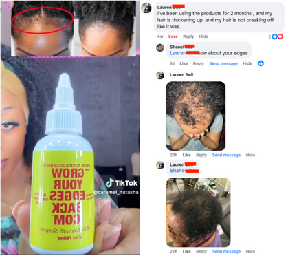 Edge & Hair Growth Oil w/ FREE Edge Brush