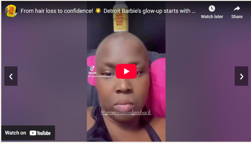 Load video: Detroit Barbie&#39;s Hair Growth Journey