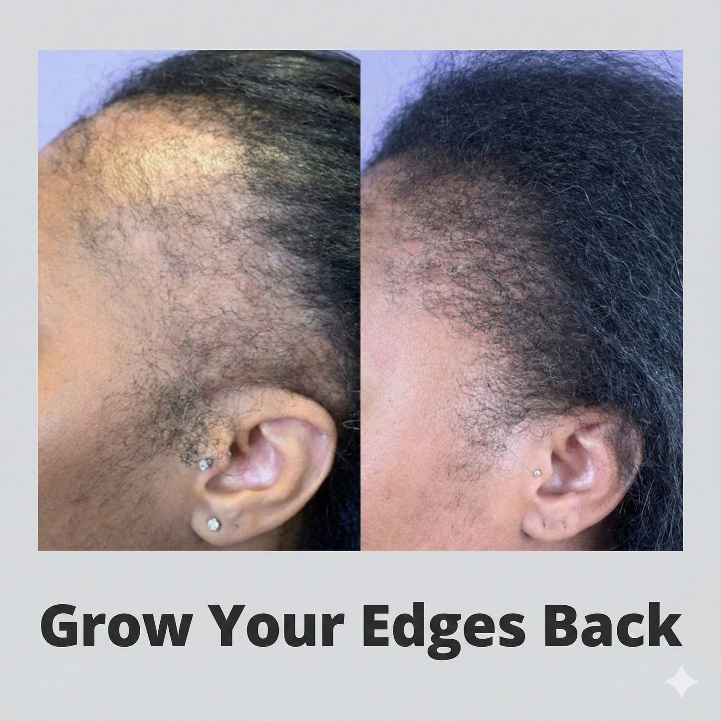 Edge & Hair Growth Oil 2-Bottle Bundle