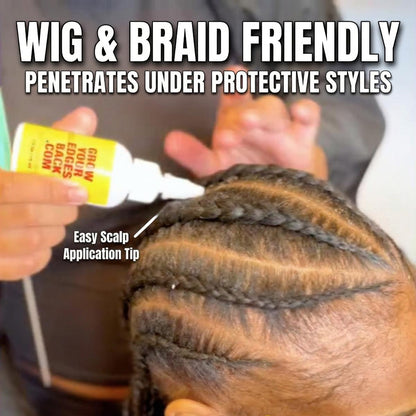 Grow Your Edges Back Hair & Edge Growth System w/ FREE Edge Brush